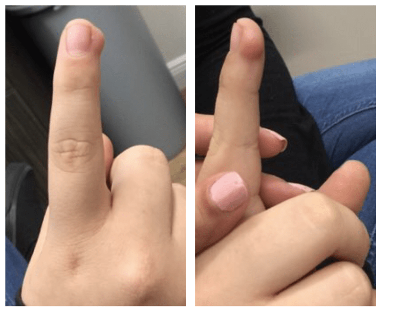 The Mysterious Meaning Behind That Itchy Right Index Finger
